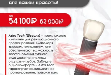 Имплантация Astra Tech